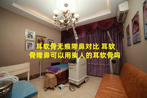 耳软骨无痕隆鼻对比 耳软骨隆鼻可以用别人的耳软骨吗